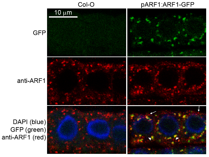 immunofluorescence using anti-Arf1 antibodies